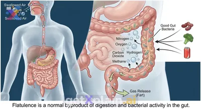 What Makes Our Bodies Fart and Why Is It Normal?